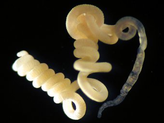 Olavius algarvensis.  C. Lott/HYDRA/ Max Planck Institute for Marine Mikrobiology, Bremen